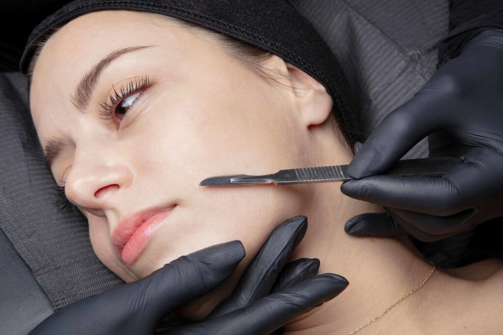 What is dermaplaning What are its benefits