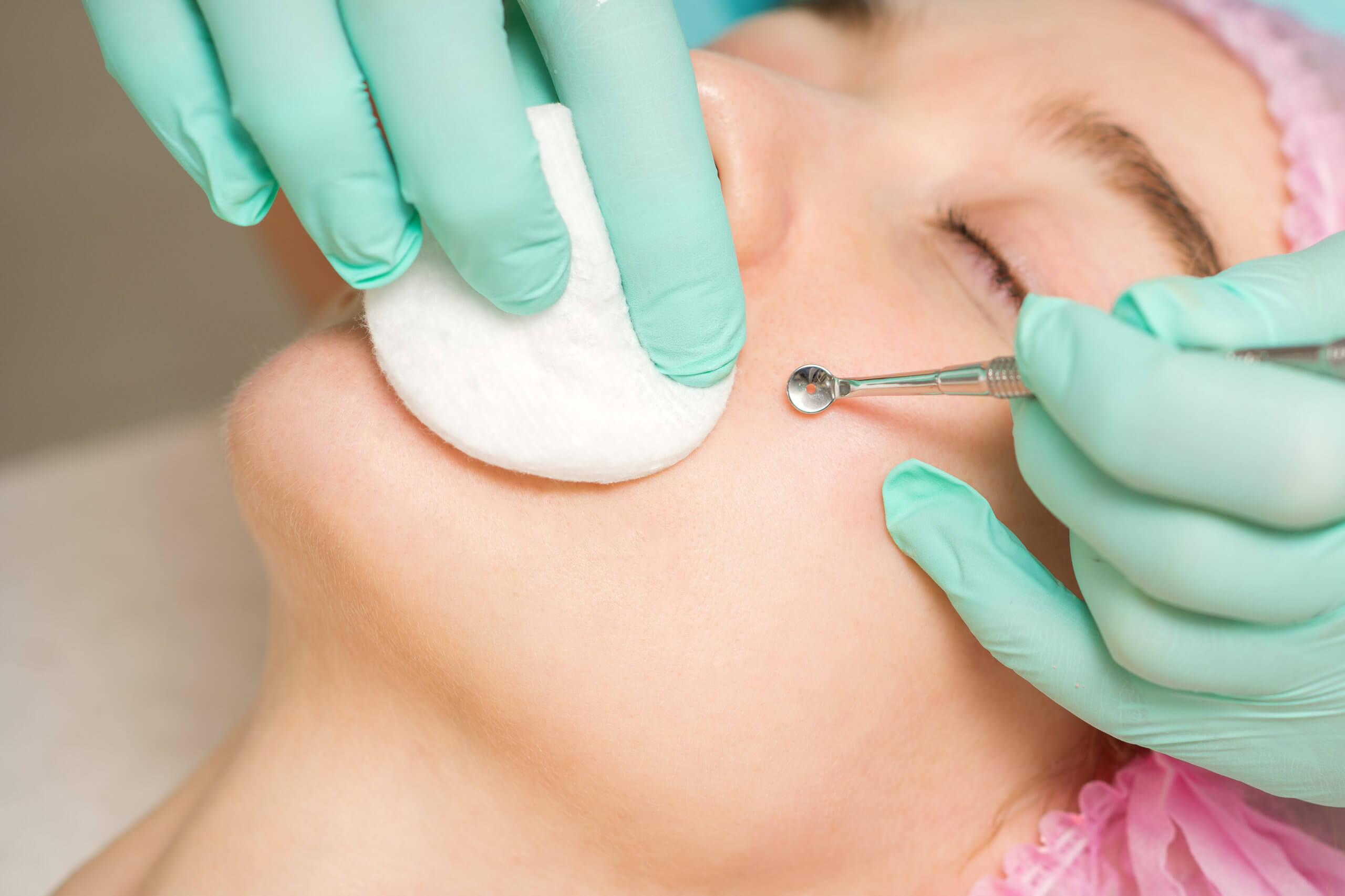The beautician removes blackhead and acne on the female face in a beauty salon, blackhead removal tool.