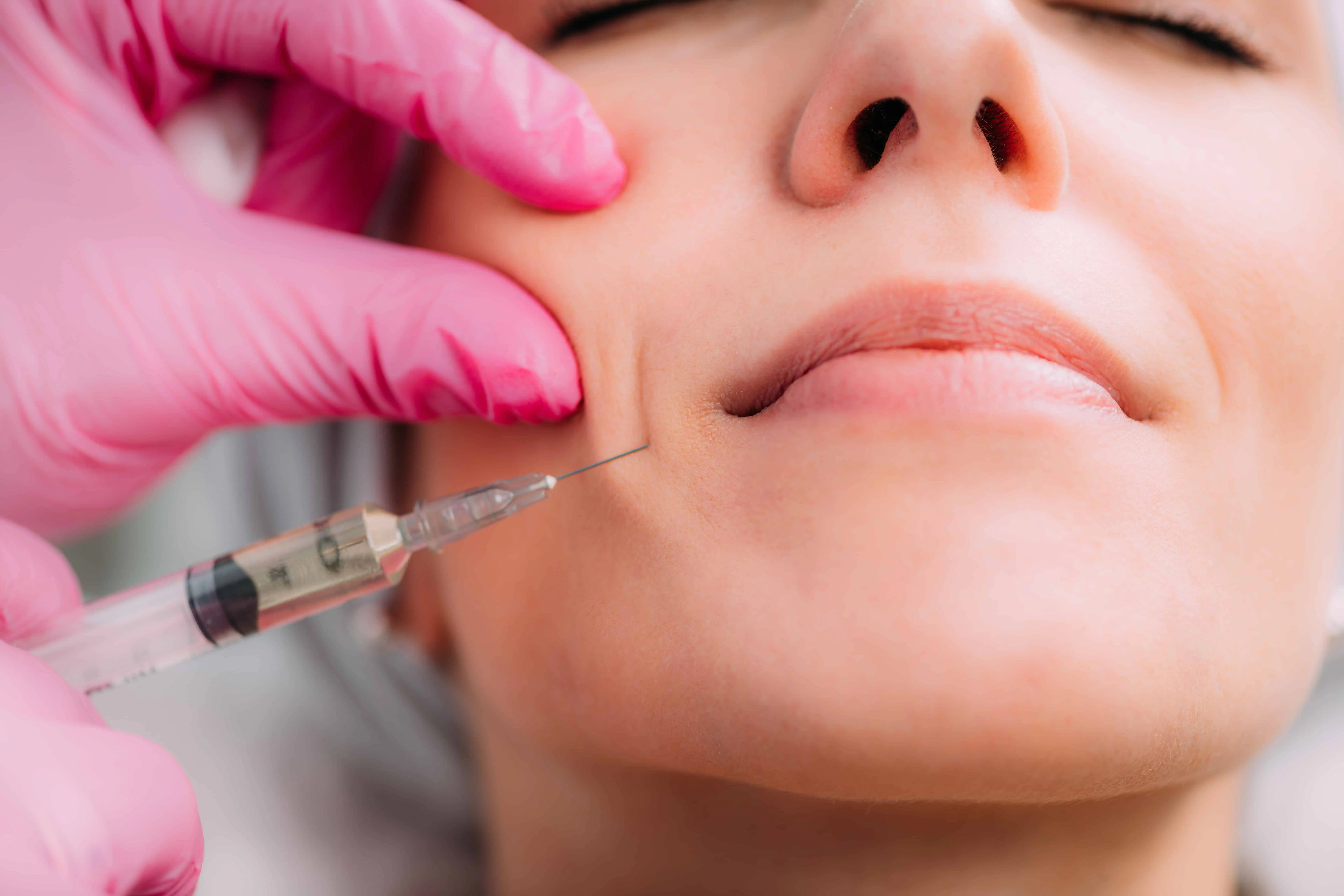Fillers in Leominister, MA MD Esthetics